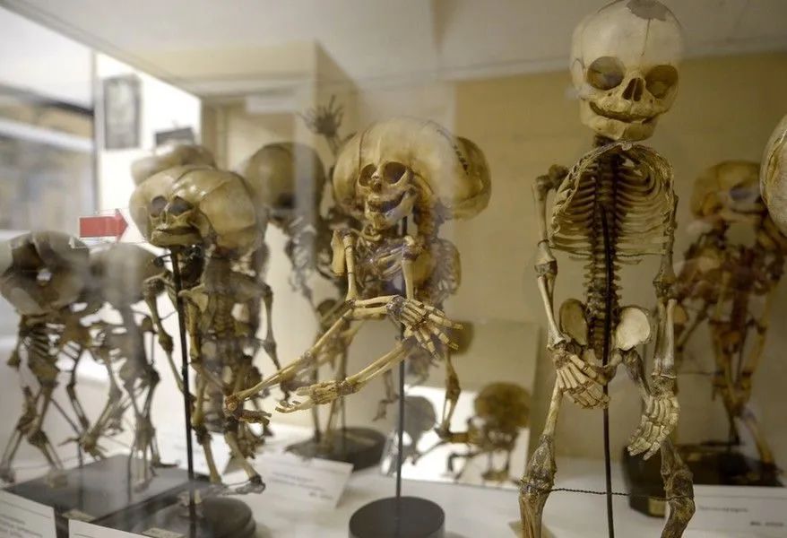 Городские легенды гласят, что в этих подвалах Кунскамеры император проводил научные эксперименты