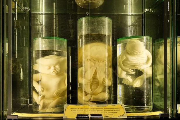 Восковые фигуры, старинные медицинские инструменты и чучела в тематических залах — анатомические аномалии людей и животных.